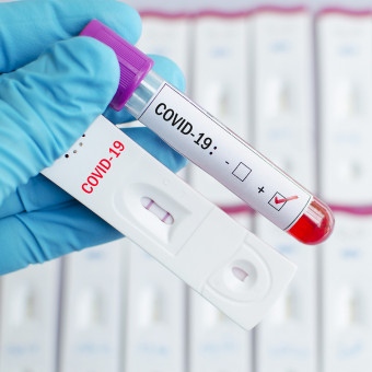 Предлагат безплатни антигенни тестове за COVID-19
