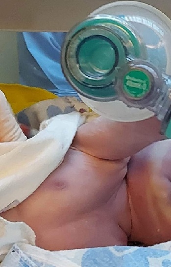 Жена с тежка сърдечна малформация роди здраво бебе