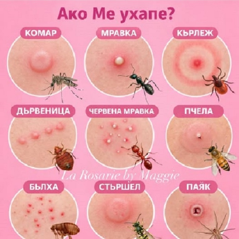 Ако нещо ме ухапе, какво да направя бързо